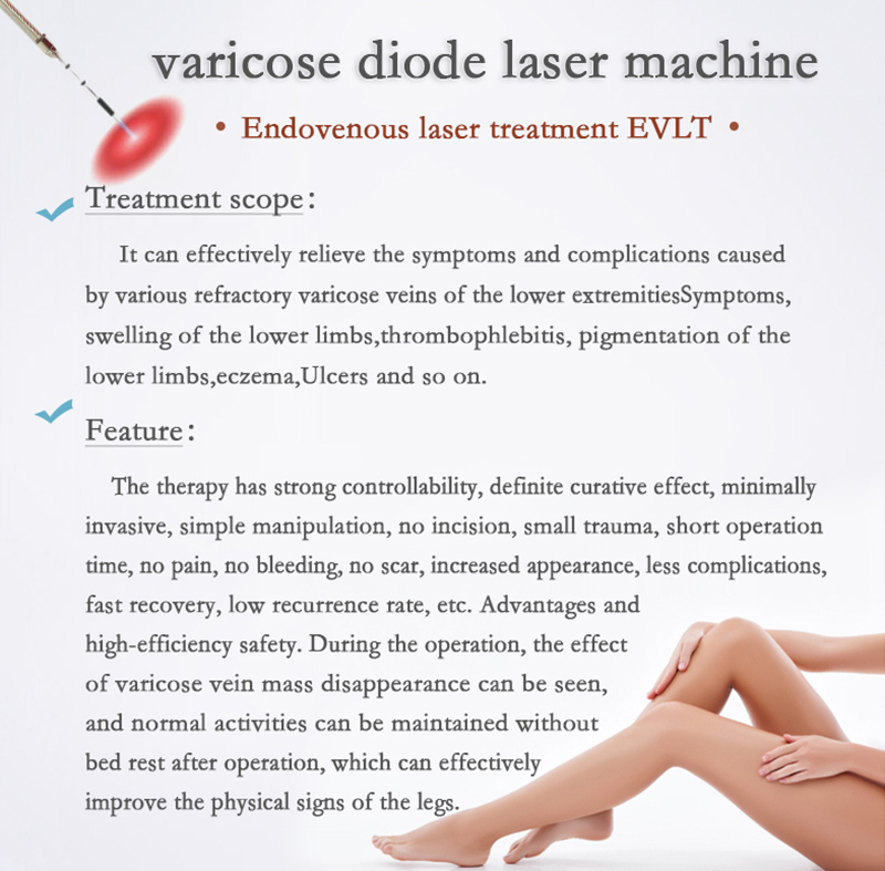 varicose-vein-diode